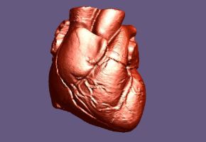 A new test called the AlloMap has been approved by the FDA to reduce the need for heart transplant recipients to undergo continuous biopsies to insure their organ is not being rejected by their bodies